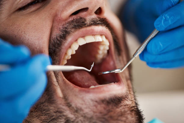 Best Orthodontic Emergency Dentist in Fort Meade, FL