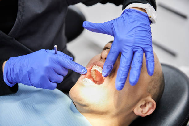 Best Emergency Dentist for Knocked-Out Tooth in Fort Meade, FL